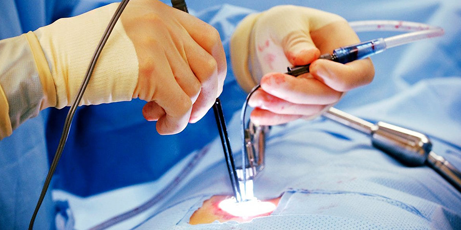 General Surgeries